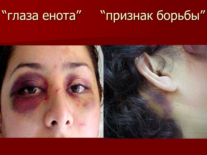 “глаза енота”     “признак борьбы”